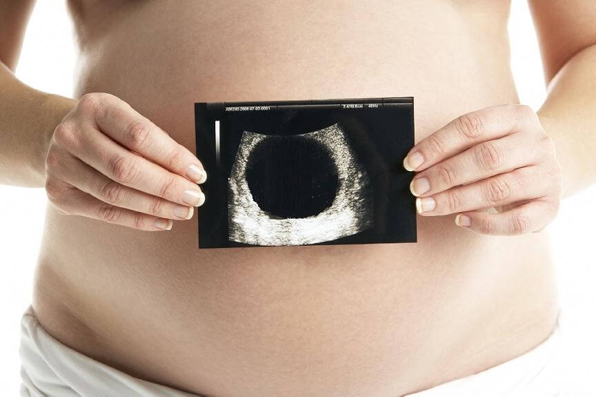 Почему возникает анэмбриония