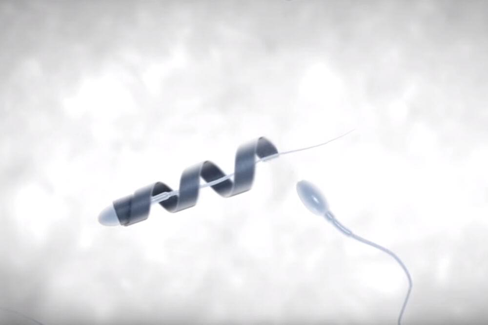 Ученые разработали спирали, помогающие в лечении мужского бесплодия