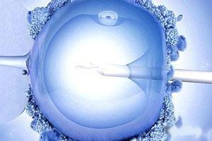 Как происходит подсадка эмбрионов при экстракорпоральном оплодотворении