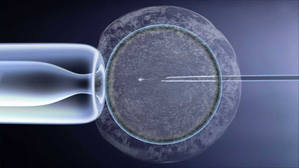 Программы ЭКО с использованием процедуры ИМСИ ИКСИ